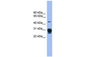 Image no. 1 for anti-Proteasome (Prosome, Macropain) 26S Subunit, Non-ATPase, 9 (PSMD9) (AA 71-120) antibody (ABIN6745292) (PSMD9 antibody  (AA 71-120))