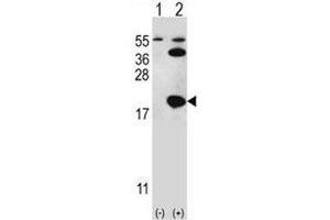 Western blot analysis of UBE2I antibody and 293 cell lysate either nontransfected (Lane 1) or transiently transfected (2) with the UBE2I gene. (UBE2I antibody  (AA 1-30))