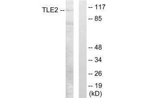 TLE2 antibody