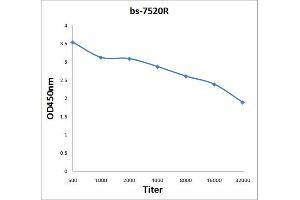 Antigen: 2 µg/100 µL  Primary: Antiserum, 1:500, 1:1000, 1:2000, 1:4000, 1:8000, 1:16000, 1:32000;  Secondary: HRP conjugated Rabbit Anti-Goat IgG at 1: 5000;  TMB staining Read the data in Microplate Reader by 450nm. (SPON1 antibody  (AA 741-807))
