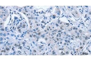 ARHGEF2 antibody