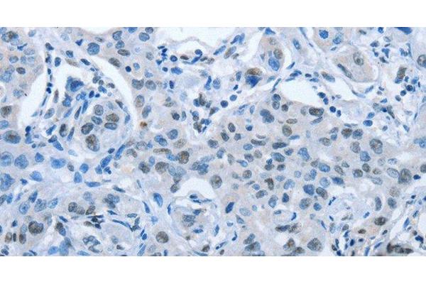 ARHGEF2 antibody