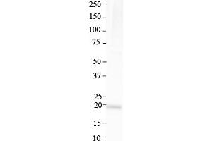 Host:  Rabbit  Target Name:  ATP6V0C  Sample Type:  Human Lung  Antibody Dilution:  1. (ATP6V0C antibody  (Middle Region))