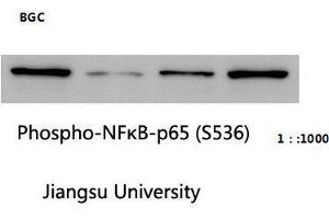 Western Blot (WB) analysis: Please contact us for more details. (NF-kB p65 antibody  (pSer536))