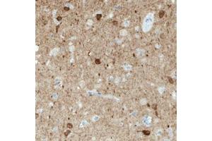 Immunohistochemical staining (Formalin-fixed paraffin-embedded sections) of human cerebral cortex with NECAB1 monoclonal antibody, clone CL0576  shows immunoreactivity in a subset of neuronal cells. (NECAB1 antibody)