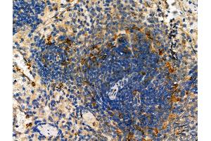 ABIN6261515 and ABIN6278456 at 1/100 staining Rat spleen tissue by IHC-P. (ELMO1 antibody  (C-Term))
