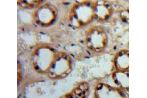 IHC-P analysis of Adrenal tissue, with DAB staining. (ADCY1 antibody  (AA 835-1061))