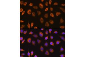 Immunofluorescence analysis of L929 cells using SEL1L antibody (ABIN6132642, ABIN6147499, ABIN6147500 and ABIN6215644) at dilution of 1:100. (SEL1L antibody  (AA 22-190))