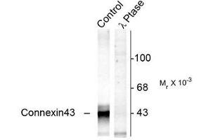 Image no. 1 for anti-Gap Junction Protein, alpha 1, 43kDa (GJA1) (pSer368) antibody (ABIN372603) (Connexin 43/GJA1 antibody  (pSer368))