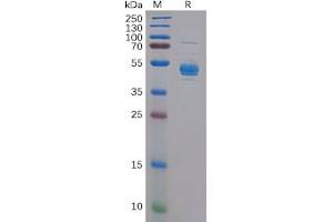 Human CLEC2D Protein, hFc Tag on SDS-PAGE under reducing condition.