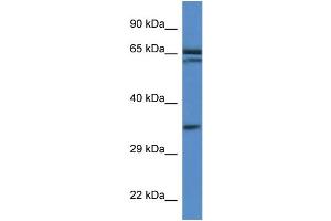 WB Suggested Anti-Terf2ip Antibody Titration: 1. (RAP1 antibody  (Middle Region))