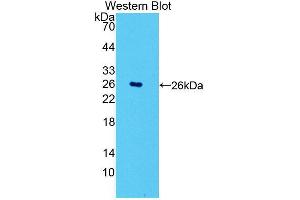 Western blot analysis of the recombinant protein. (POMT1 antibody  (AA 318-513))