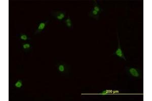 Image no. 3 for anti-Pre-B-Cell Leukemia Homeobox Protein 1 (PBX1) (AA 213-322) antibody (ABIN598855) (PBX1 antibody  (AA 213-322))