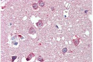 Brain, cortex, Human: Formalin-Fixed, Paraffin-Embedded (FFPE) (Reticulon 4 antibody  (AA 501-515))
