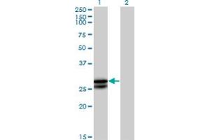 Western Blot analysis of OSM expression in transfected 293T cell line by OSM MaxPab polyclonal antibody.