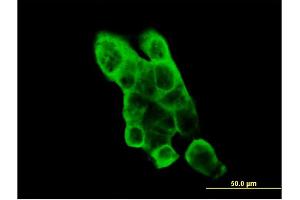 Immunofluorescence of monoclonal antibody to EPHA2 on A-431 cell. (EPH Receptor A2 antibody  (AA 204-326))