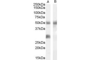 Western Blotting (WB) image for anti-Dual Specificity Phosphatase 11 (RNA/RNP Complex 1-Interacting) (DUSP11) (Middle Region) antibody (ABIN2778853) (DUSP11 antibody  (Middle Region))