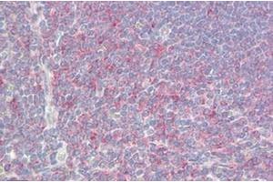 Human Spleen: Formalin-Fixed, Paraffin-Embedded (FFPE) (NREP antibody  (Internal Region))