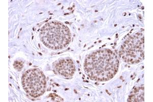 Immunohistochemistry (IHC) image for anti-Secretoglobin, Family 2A, Member 2 (SCGB2A2) antibody (ABIN6940039)