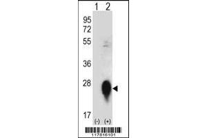 Western blot analysis of CLEC3B using rabbit polyclonal CLEC3B Antibody using 293 cell lysates (2 ug/lane) either nontransfected (Lane 1) or transiently transfected (Lane 2) with the CLEC3B gene. (CLEC3B antibody  (AA 95-122))