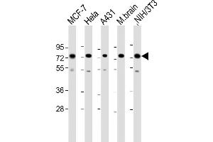 Western Blot at 1:2000 dilution Lane 1: MCF-7 whole cell lysate Lane 2: Hela whole cell lysate Lane 3: A431 whole cell lysate Lane 4: mouse brain lysate Lane 5: NIH/3T3 whole cell lysate Lysates/proteins at 20 ug per lane. (MTA1 antibody  (C-Term))