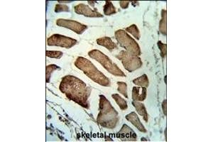 Formalin-fixed and paraffin-embedded human skeletal muscle reacted with LMOD1 Antibody (Center ), which was peroxidase-conjugated to the secondary antibody, followed by DAB staining. (Leiomodin 1 antibody  (AA 214-241))