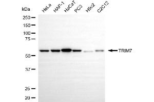 Western blotting analysis using TRIM7 antibody (ABIN7800643). (TRIM7 antibody)