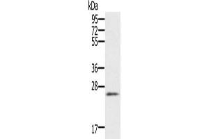 Gel: 10 % SDS-PAGE, Lysate: 40 μg, Lane: Human heart tissue, Primary antibody: ABIN7192155(RBM38 Antibody) at dilution 1/200, Secondary antibody: Goat anti rabbit IgG at 1/8000 dilution, Exposure time: 1 minute (RBM38 antibody)