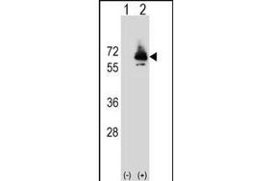 Western blot analysis of PCK2 (arrow) using rabbit polyclonal PCK2 Antibody (Q39) (ABIN392678 and ABIN2842171).