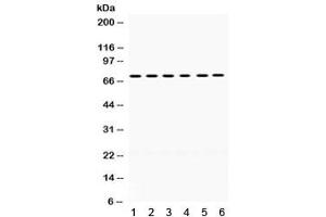 Western blot testing of mouse 1) brain, 2) liver, 3) thymus, 4) testis, 5) human 293 and 6) HeLa lysate with LIMK2 antibody. (LIMK2 antibody)