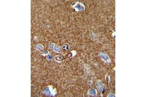Immunohistochemistry (Paraffin-embedded Sections) (IHC (p)) image for anti-ATPase, Na+/K+ Transporting, alpha 2 Polypeptide (ATP1A2) (AA 451-479) antibody (ABIN652011)