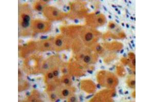 Used in DAB staining on fromalin fixed paraffin-embedded Liver tissue (CSTB antibody  (AA 1-98))