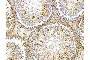 ABIN7095914 and ABIN7099976 at 1/100 staining rat testis tissue by IHC-P. (CCSER1 antibody)