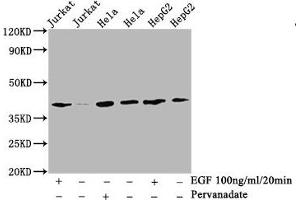 Western Blot  Positive WB detected in:Jurkat whole cell lysate, Hela whole cell lysate, HepG2 whole cell lysate(treated with EGF or Pervanadate)  All lanes: Phospho-LAT antibody at 2. (Recombinant LAT antibody  (pTyr191))