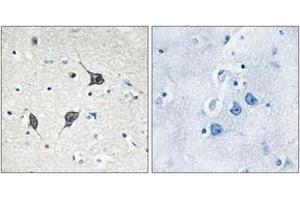 Immunohistochemistry analysis of paraffin-embedded human brain tissue, using GPR20 Antibody. (GPR20 antibody  (AA 291-340))