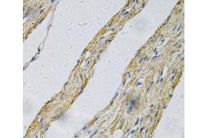 Immunohistochemistry of paraffin-embedded Human smooth muscle using PRNP Polyclonal Antibody at dilution of 1:100 (40x lens). (PRNP antibody)