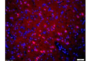Formalin-fixed and paraffin embedded rat brain labeled with Rabbit Anti-5HT2A Receptor/SR-2A Polyclonal Antibody, Unconjugated at 1:200 followed by conjugation to the secondary antibody, Goat Anti-Rabbit IgG, Cy3 conjugated used at 1:200 dilution for 40 minutes at 37 °C.