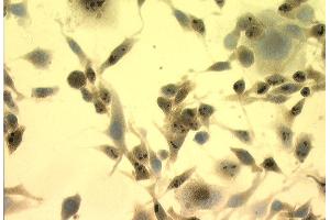 Immunocytochemistry/Immunofluorescence analysis using Mouse Anti-Hsp70 Monoclonal Antibody, Clone C92 . (HSP70 antibody  (HRP))