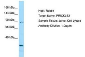 Image no. 1 for anti-Prickle Homolog 2 (PRICKLE2) (C-Term) antibody (ABIN6749993) (PRICKLE2 antibody  (C-Term))