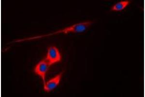 Immunofluorescent analysis of Peroxiredoxin 3 staining in MCF7 cells. (Peroxiredoxin 3 antibody  (Center))