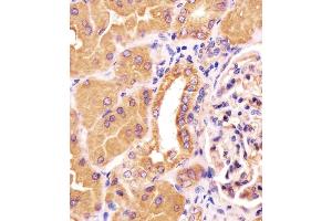 Antibody staining PCCA in human kidney tissue sections by Immunohistochemistry (IHC-P - paraformaldehyde-fixed, paraffin-embedded sections).