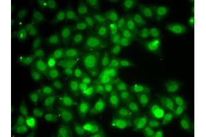 Immunofluorescence analysis of A549 cell using TRAF4 antibody. (TRAF4 antibody)