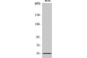 Western Blotting (WB) image for anti-Ets Variant 1 (ETV1) (N-Term) antibody (ABIN3174998) (ETV1 antibody  (N-Term))