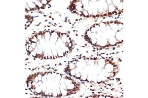 Immunohistochemistry of paraffin-embedded human colon using CDC16 Rabbit mAb (ABIN1678585, ABIN3017837, ABIN3017838 and ABIN7101525) at dilution of 1:100 (40x lens). (CDC16 antibody)