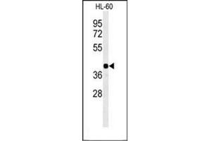 Western blot analysis of RGR Antibody  in HL-60 cell line lysates (35ug/lane). (RGR antibody  (Middle Region))