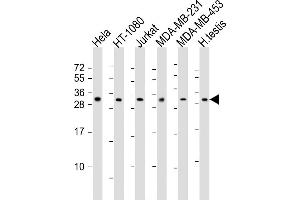 All lanes : Anti-SSX2 Antibody (Center) at 1:2000 dilution Lane 1: Hela whole cell lysates Lane 2: HT-1080 whole cell lysates Lane 3: Jurkat whole cell lysates Lane 4: MDA-MB-231 whole cell lysates Lane 5: MDA-MB-453 whole cell lysates Lane 6: human testis lysates Lysates/proteins at 20 μg per lane. (SSX2 antibody  (AA 110-142))