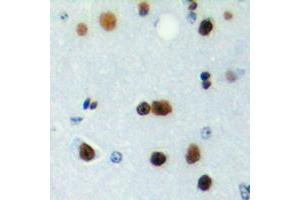 Immunohistochemical analysis of ICER staining in human brain formalin fixed paraffin embedded tissue section. (CREM antibody  (Center))