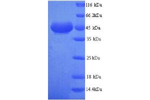 SDS-PAGE (SDS) image for Alcohol Dehydrogenase 7 (Class IV), mu Or sigma Polypeptide (ADH7) (AA 1-386), (full length) protein (His tag) (ABIN4975752) (ADH7 Protein (AA 1-386, full length) (His tag))