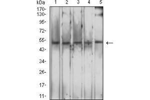 Western Blotting (WB) image for anti-Macrophage Scavenger Receptor 1 (MSR1) (AA 275-451) antibody (ABIN7193254)