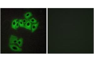 Immunofluorescence analysis of A549 cells, using VAMP4 (Ab-30) Antibody. (VAMP4 antibody  (AA 1-50))
